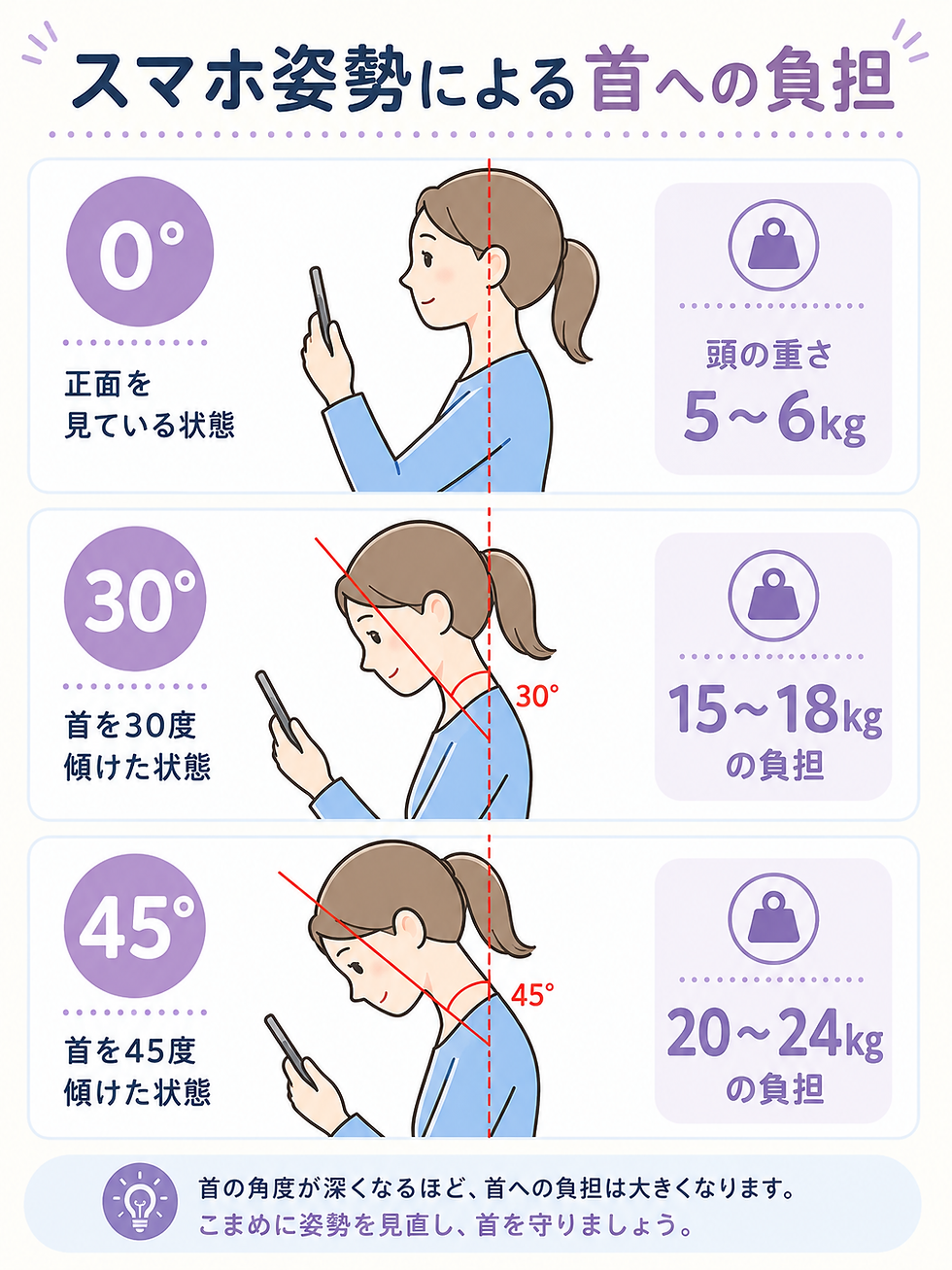 スマホを見るときの首の角度によって頸部への負担が増えることを示した図。0度で5〜6kg、30度で15〜18kg、45度で20〜24kgの負担