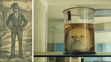 Diogo Alves: The Aqueduct Murderer and His Preserved Head
