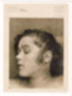 Valentine Botelin following her autopsy on September 14, 1904. After her head and hair were cleaned, the police were able to observe wounds made by three projectiles from a firearm on the woman’s temple and left cheek.