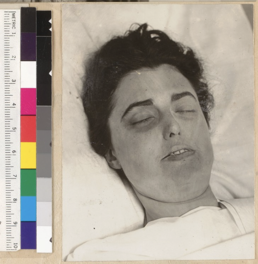 Virginia Rappe Death The Tragic Death Of Virginia Rappe And The Trials Of Fatty Arbuckle