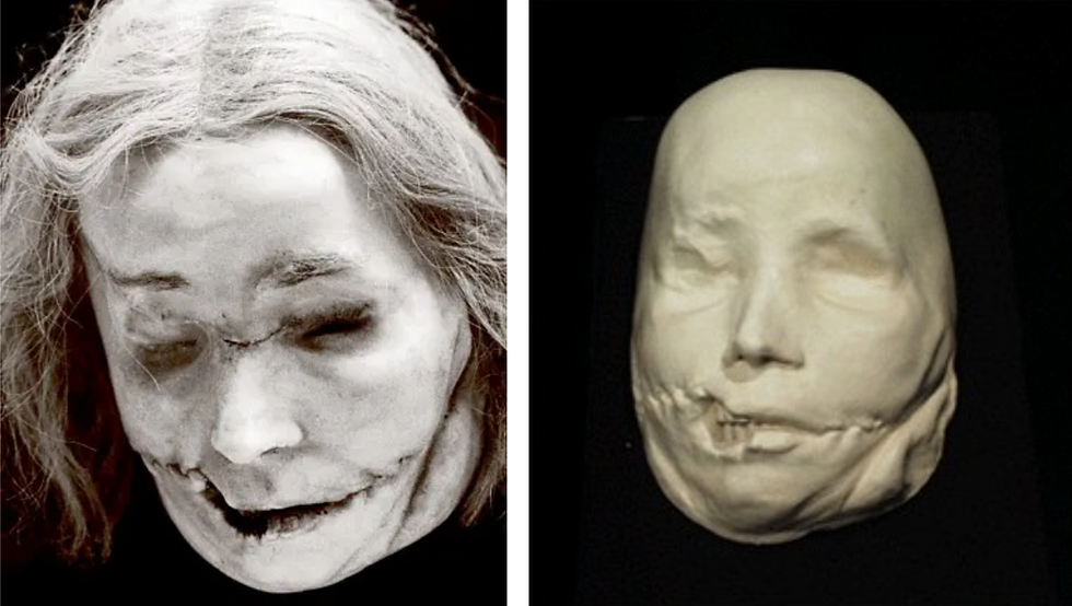 Anna's body was quickly removed and undresed for scientific experiments. Her heart was removedwhile it was still beating. The head was assigned to an artist, who made a death mask for theWax Museum "Panoptikum" in Stockholm.