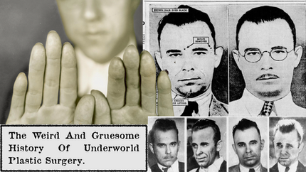 Collage of a man's hands, mugshots before and after plastic surgery. Text: "The Weird and Gruesome History of Underworld Plastic Surgery."