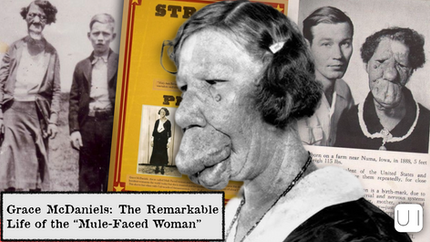 A collage showing a woman with a unique facial feature, historical photos, and a yellow poster. Text: "Grace McDaniels: The Remarkable Life..."