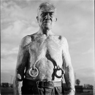 Elderly shirtless man with medical sensors attached to his bare chest outdoors.