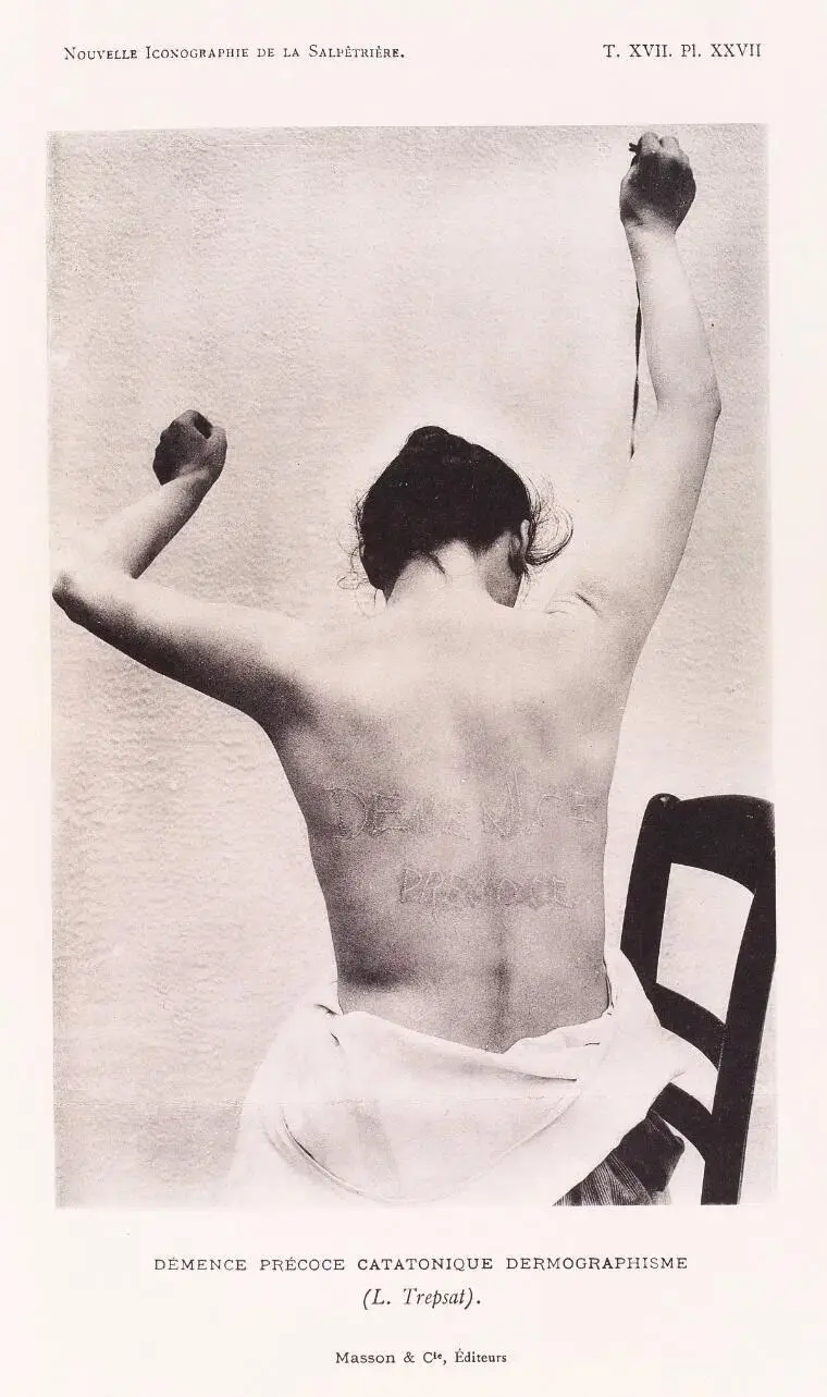 Rear view of a person with arms raised, showing text marked on their back. Black and white photo with French text above and below.