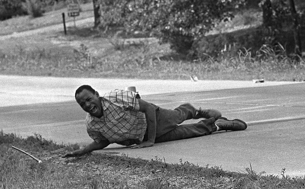 James Meredith wounded after being shot on June 7, 1966