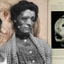 When Syphilis Was a Death Sentence: The Haunting Reality Before Penicillin