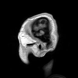 Parasagittal MRI of human