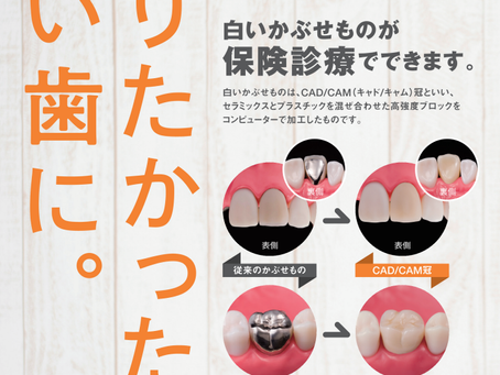 保険治療で白い歯(被せ)に