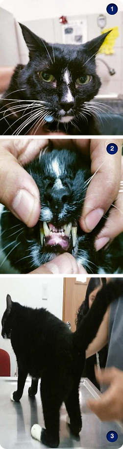 Figura 1. Rostro del paciente en donde se aprecian rasgos faciales amplios y pómulos prominentes.