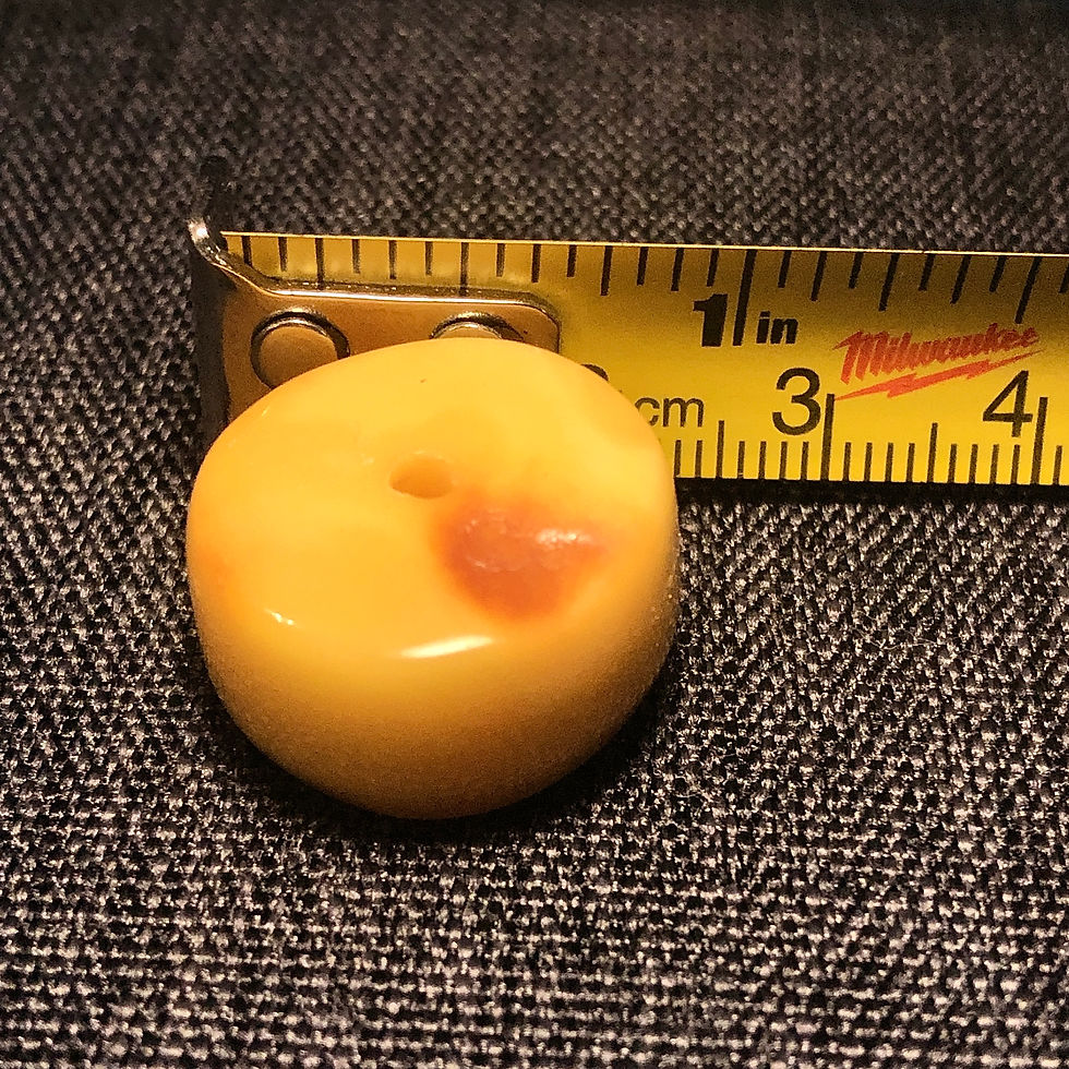 Thumbnail: Baltic Amber - Bead Round - 1 Count 