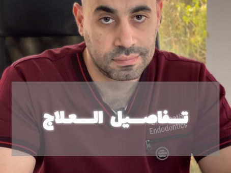 هل جودة علاج عصب الاسنان بتفرق بين الاطباء؟