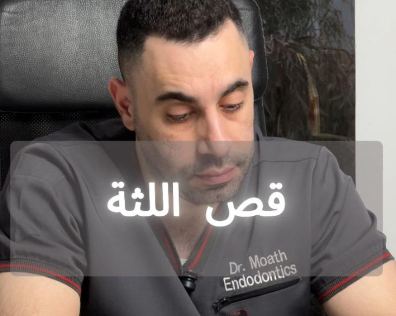علاج التهاب اللثة والتضخم عن طريق قص اللثة