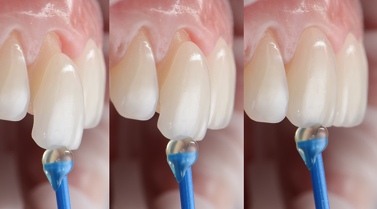 gianluca giorgini dentista roma estetica dentale faccette