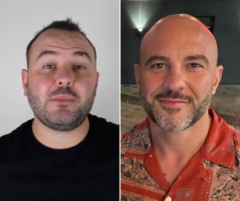 Why I Lost The Weight