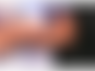 Making Sense of the Monkeypox Outbreak