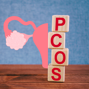 SINDROME DELL'OVAIO POLICISTICO (Parte2): La Diagnosi