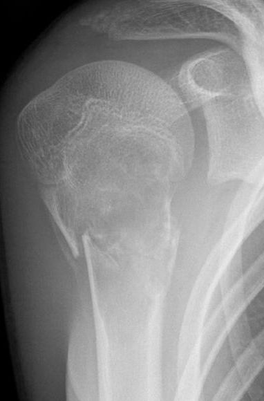 Grafi: Kinderradiologie Olgahospital Klinikum Stuttgart / Wikimedia Commons