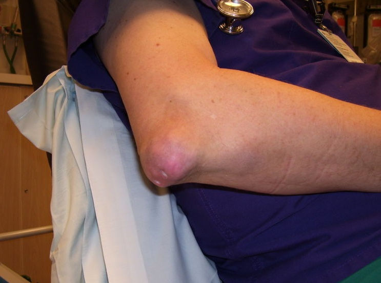 Tofüs. Foto: NickGorton /Wikimedia Commons