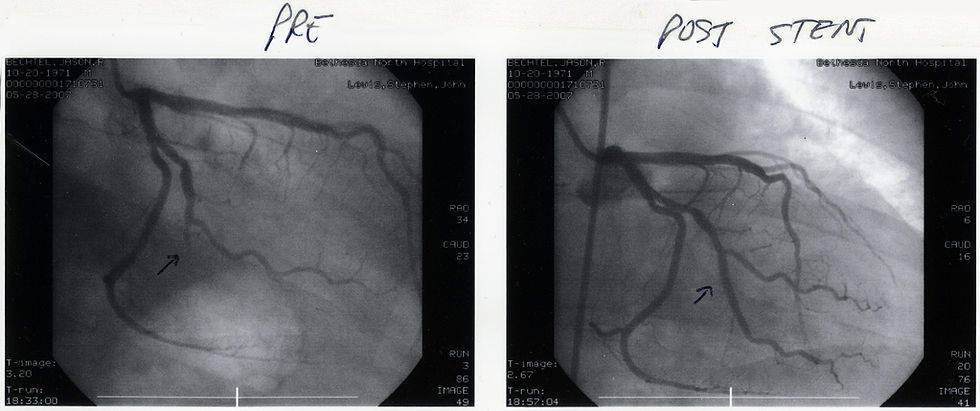 Foto: JasonBechtel / Flickr