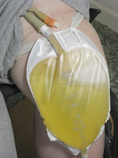 Foto: Libby Welch / Wellcome Images