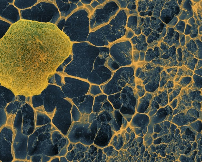 Delikli hidrojel matrikse gömülü bir kök hücre. Foto: Sílvia A Ferreira, Cristina Lopo and Eileen Gentleman, KCL, Wellcome Images