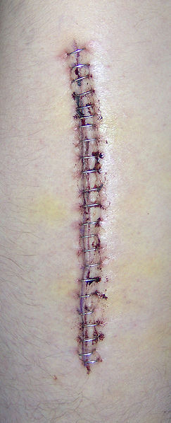 Foto: Booyabazooka / Wikimedia Commons