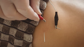 Pregnancy in Balance: Why Acupuncture is the Doula’s Secret Weapon