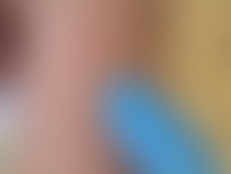 Xavfli afsona: mikrosporiya va mushuklar haqidagi haqiqat