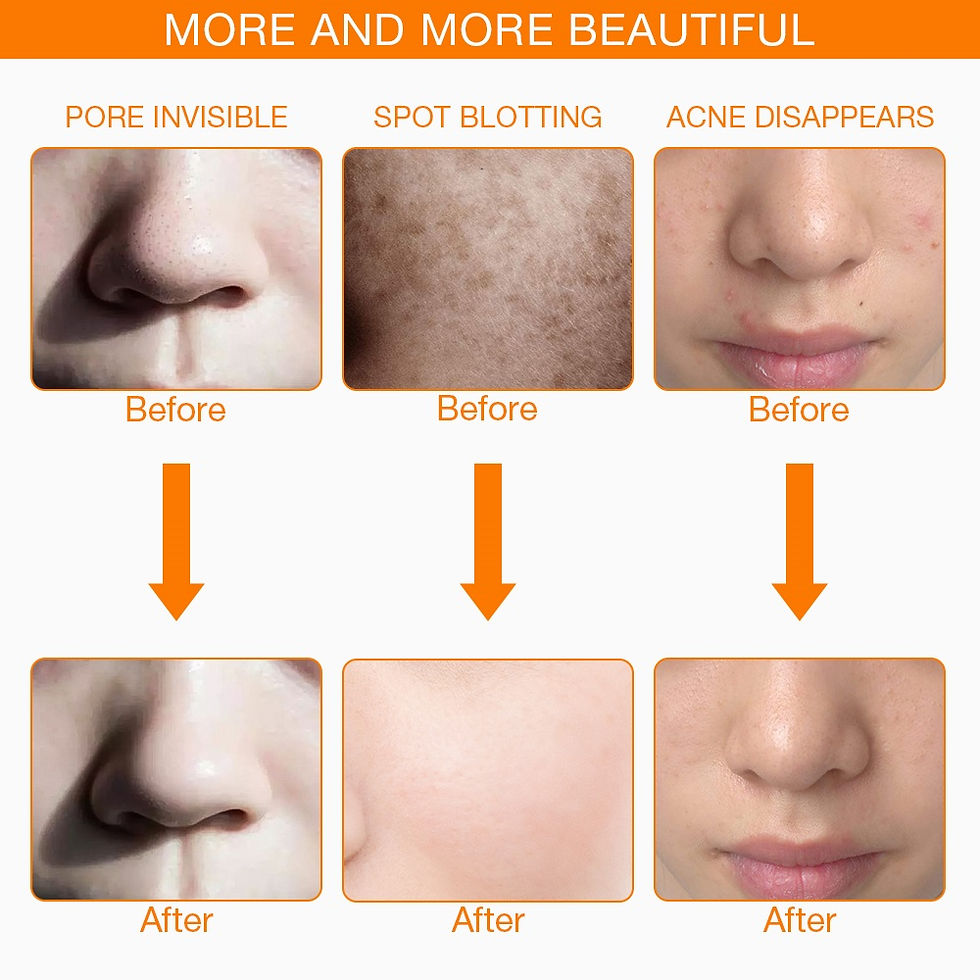 Thumbnail: VIP Facial LED Mask with Neck LED Light Therapy for Skin Rejuvenation 