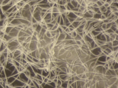wiggle-worms.gif.opt405x303o0,0s405x303.gif