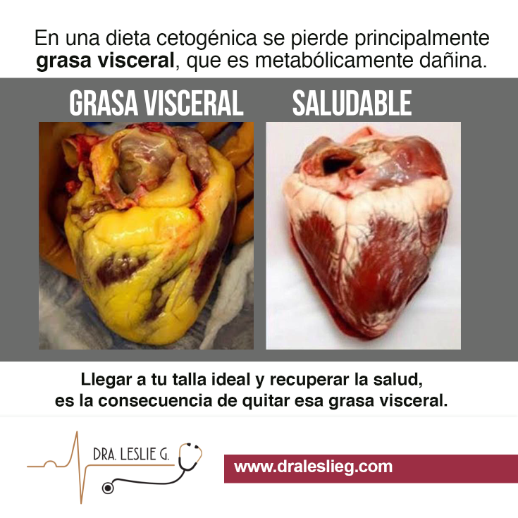 Como quitar la grasa visceral