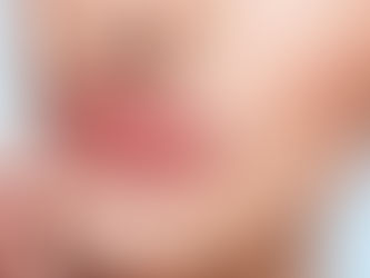 Enhance Your Look with 1ml Natural Lip Fillers: Complete Guide