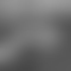 痛みが戻るのはなぜ?代償動作から見る身体の負担の仕組み