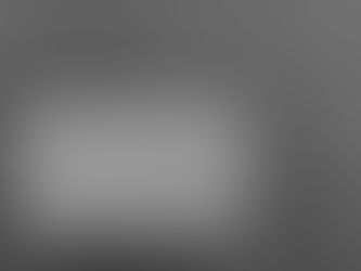 股関節の痛みはどこから来るのか ― 原因は骨だけではないという視点 ―