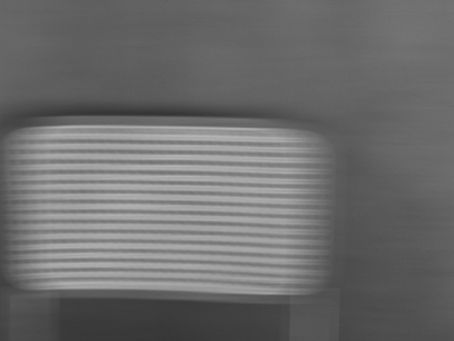 股関節の痛みはどこから来るのか ― 原因は骨だけではないという視点 ―