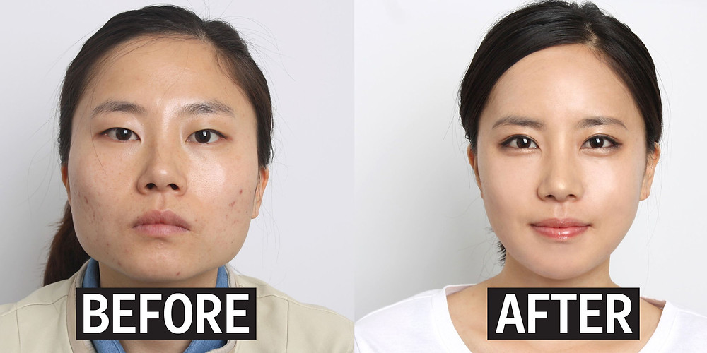 South Korean plastic surgery cookingwiththehamster
