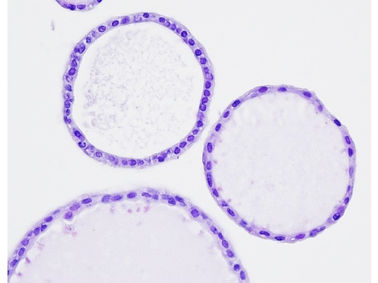 ovarian organoid.jpg