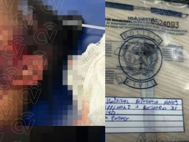 Arma do crime e ferimento da mulher, vítima de tentativa de feminicídio.