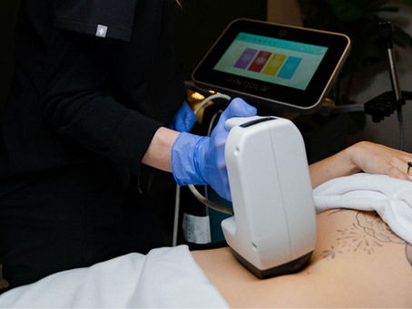 fat reduction treatment nanaimo