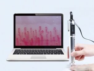 《血管・血流の観察》導入します!