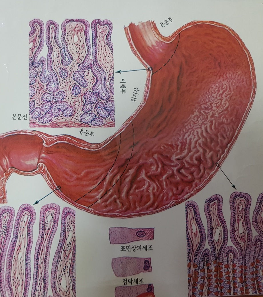 기능성 소화불량 : 체함과 위장병