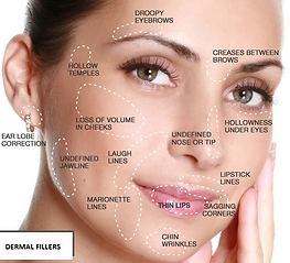 ACIDO HIALURONICO AUMENTO LABIOS ELLANSE