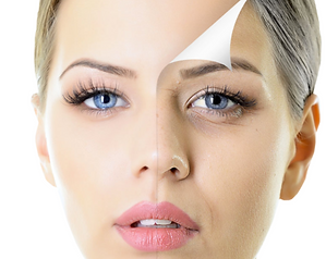ELIMINAR MANCHAS CARA PEELING LASER