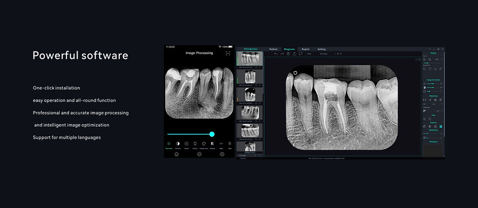 Miniatyrbild: i-Scan Imaging Plate Scanner