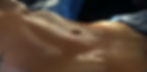 lipoabdominoplastia-en-torreon