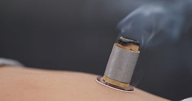 chinese-medicine-moxibustion-therapy-XEPYKKR-2048x1080.jpg