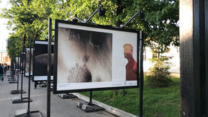 ФОТОВЫСТАВКА «КОЖА: ЛУННЫЙ ПЕЙЗАЖ» В ПАРКЕ ГОРЬКОГО