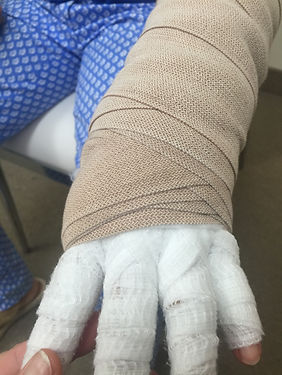 Bandaging Example