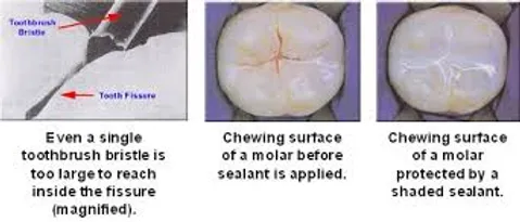 sealant.webp